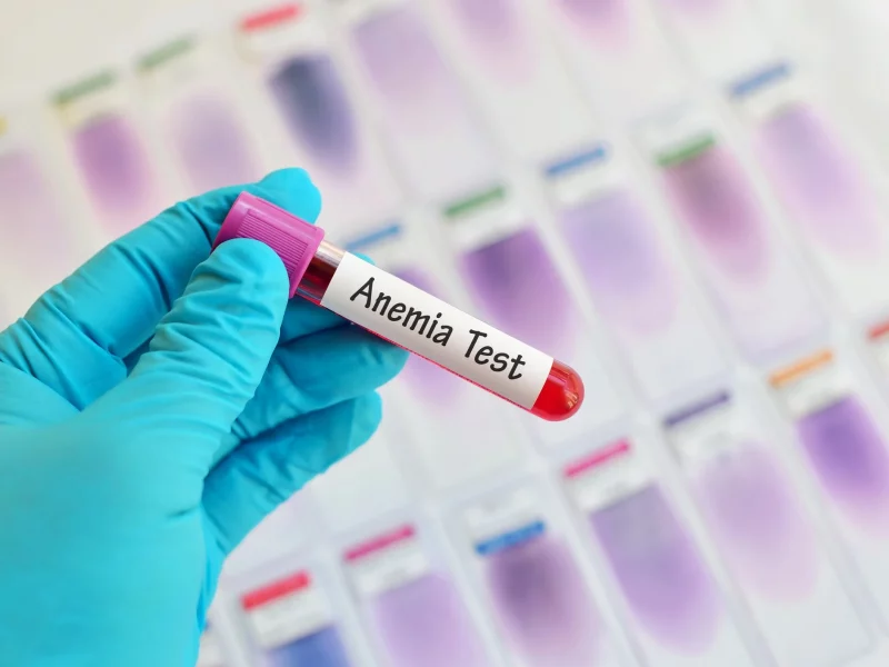 Anemia 1