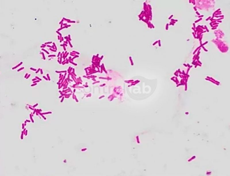 Bacterioscopia GRAM VET