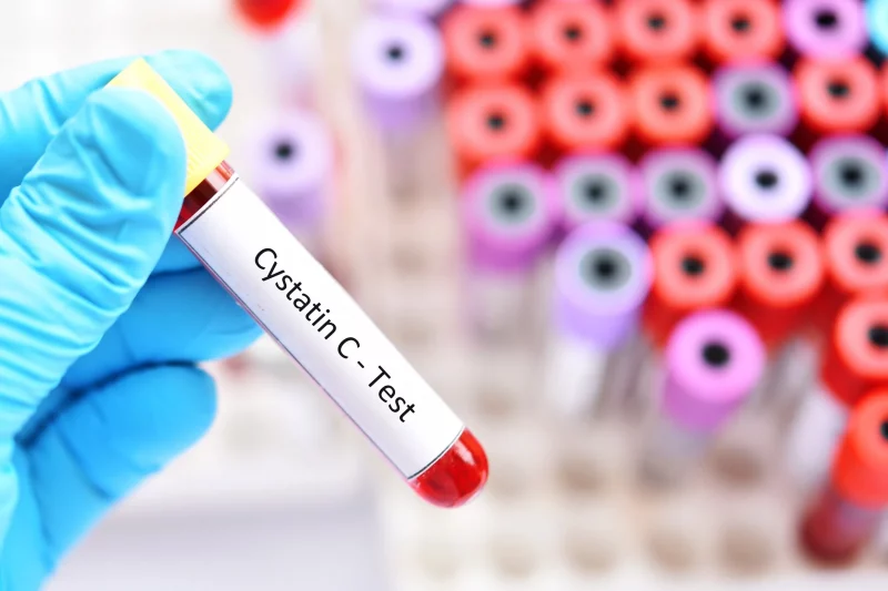 Tubo de amostra de sangue para teste de cistatina C