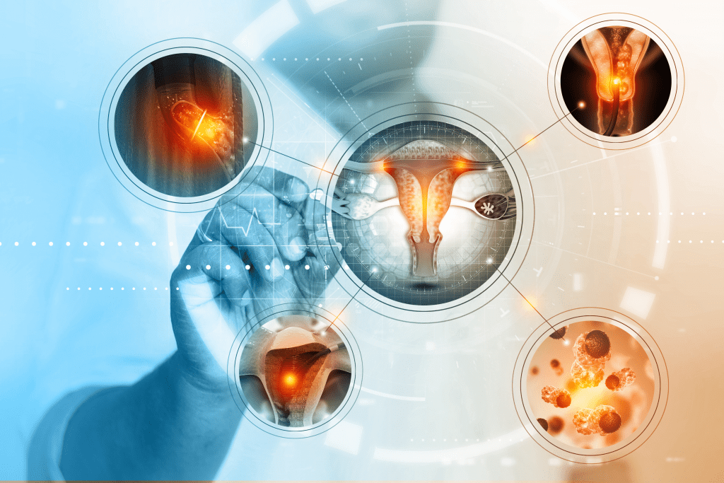 Critérios citomorfológicos das principais lesões e carcinomas do colo uterino