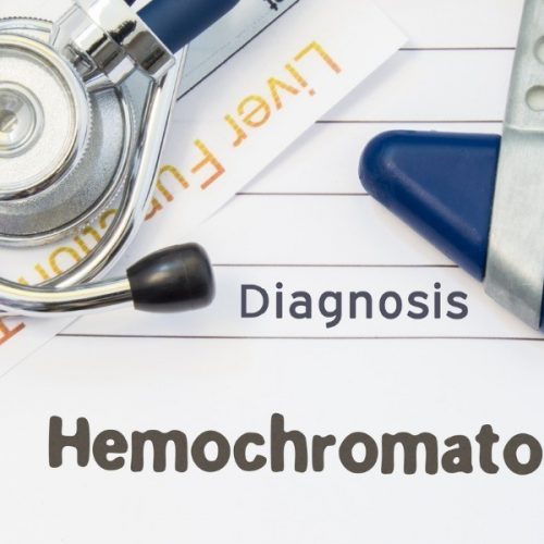 Hemocromatose diagnosis hemochromatosis neurological hammer stethoscope and liver picture id910636670