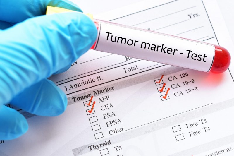 Amostra de sangue para teste de marcador tumoral