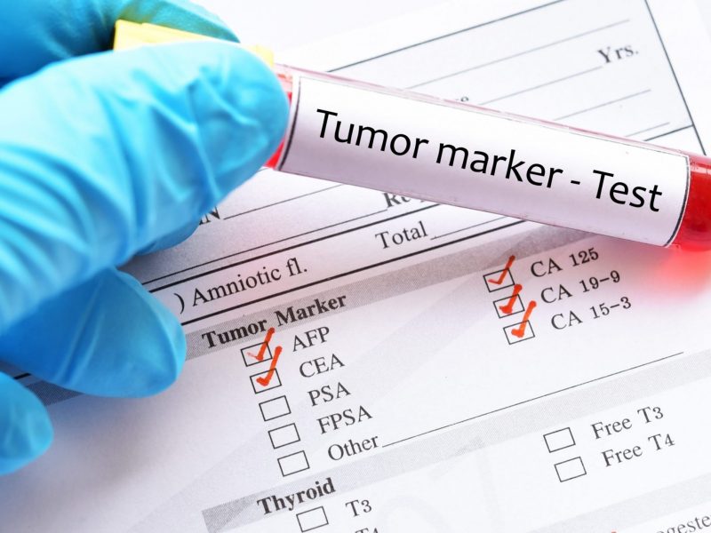 Amostra de sangue para teste de marcador tumoral