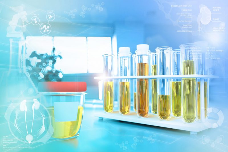 Teste de amostra de urina para nitrito ou bactéria - tubos de ensaio no escritório de pesquisa de química moderna, ilustração médica 3D