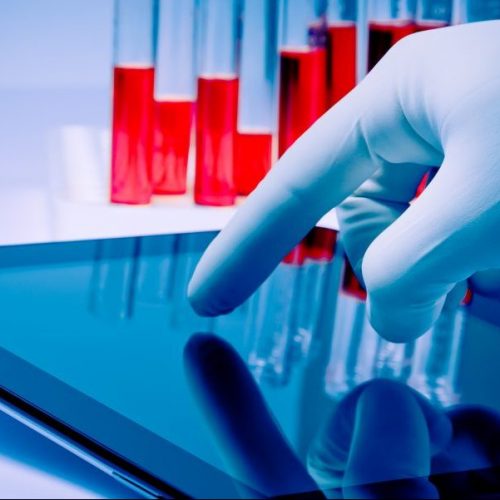 mão na luva médica azul tocando tablet digital em laboratório